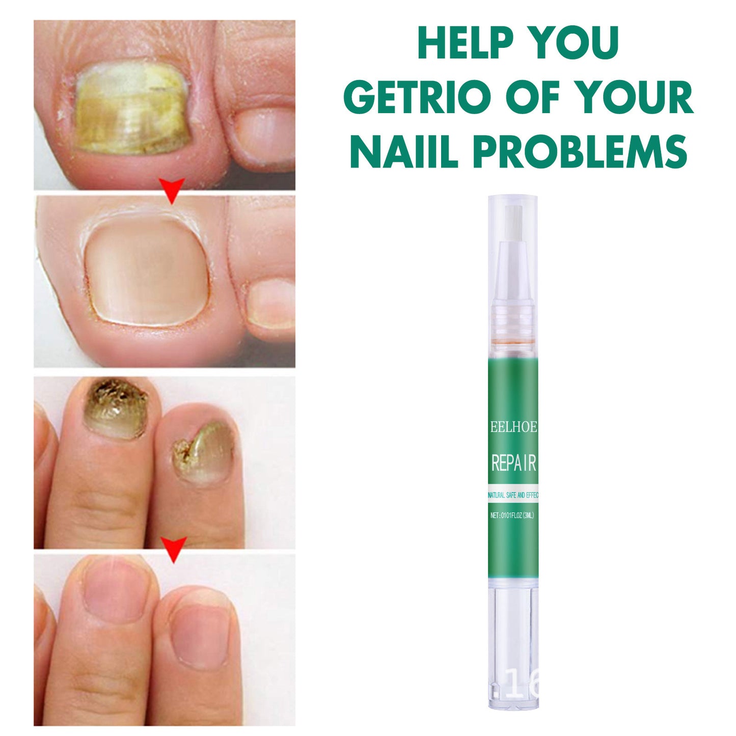Nutrition Pen Repair Nails